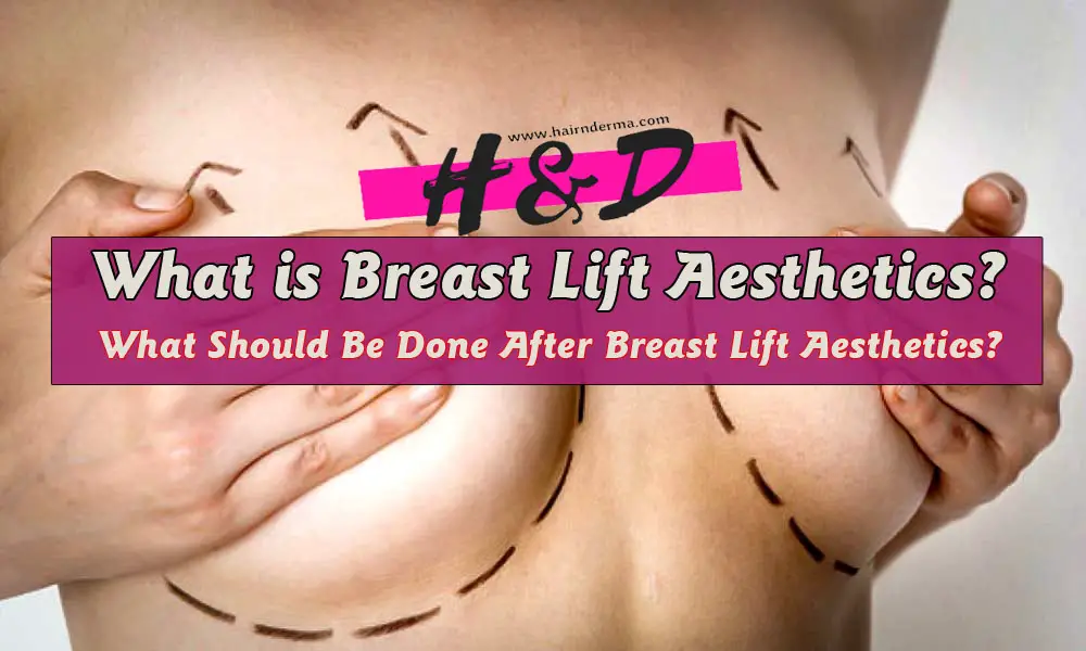  What Should Be Done After Breast Lift Aesthetics?