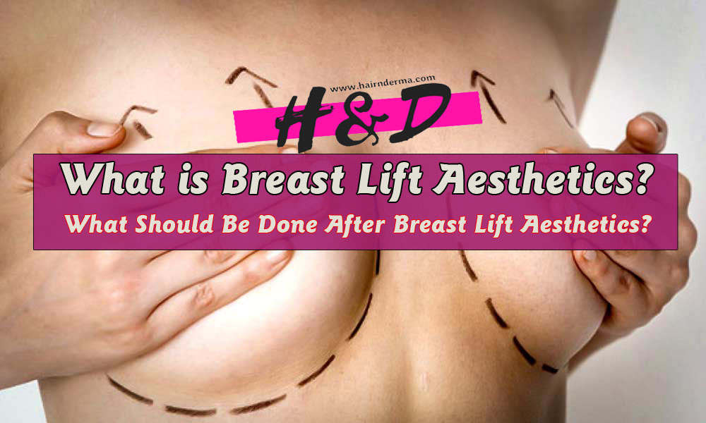What Should Be Done After Breast Lift Aesthetics?