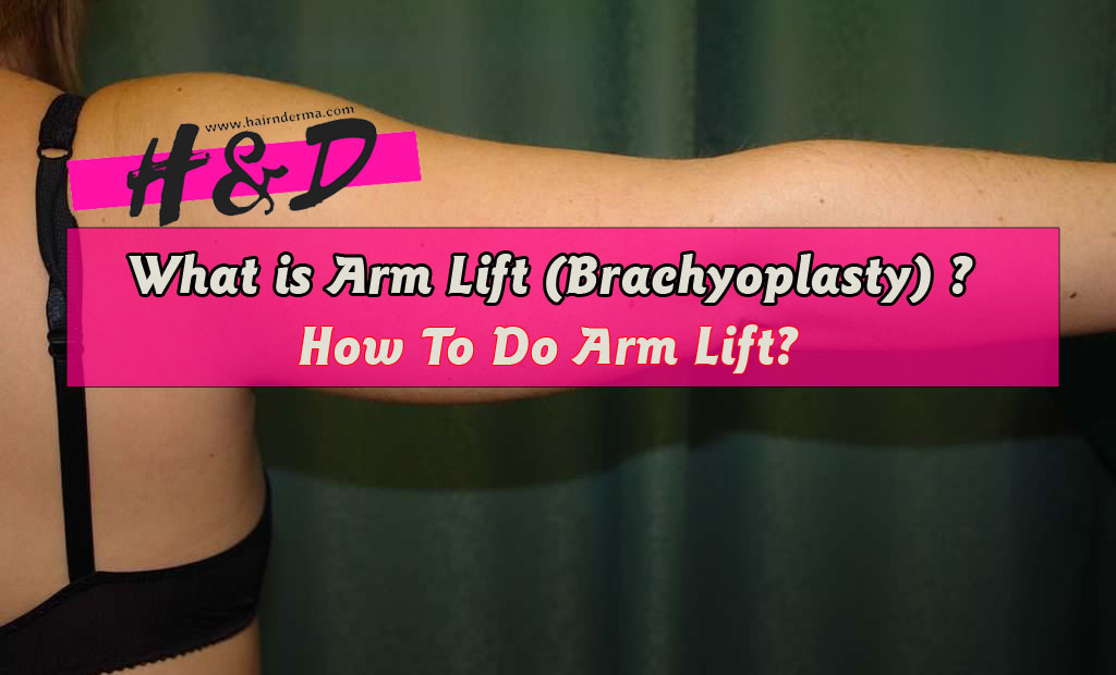  How To Do Arm Lift? brachioplasty