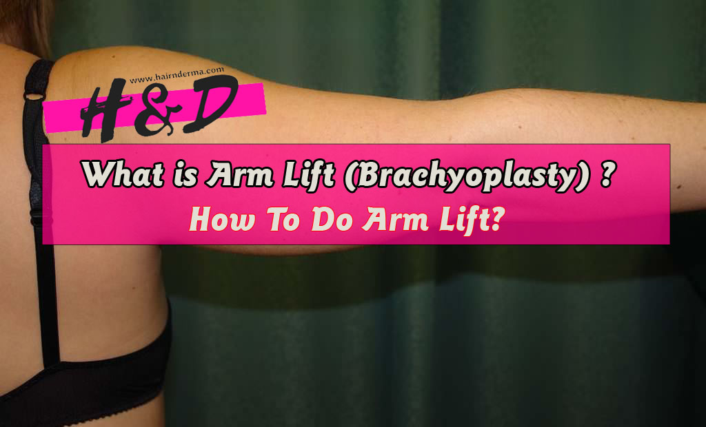 How To Do Arm Lift? brachioplasty