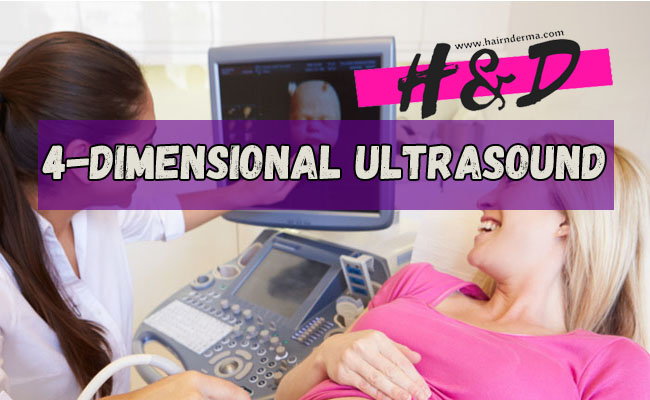 4-Dimensional Ultrasound