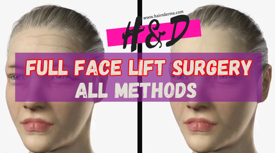 what is full face lift
