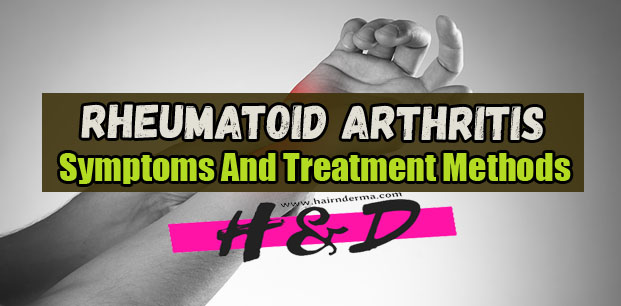Rheumatoid arthritis symptoms